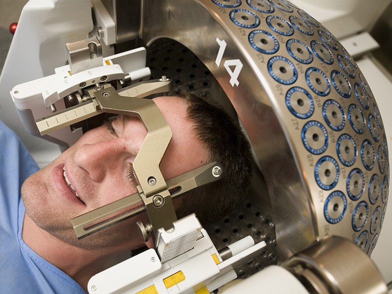 Stereotactic Radiosurgery Solutions